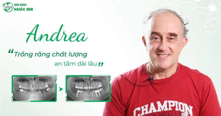 khach hang implant khich thuoc lon