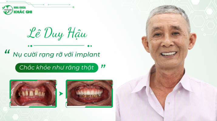 Le Duy Hau Thumbnail Website