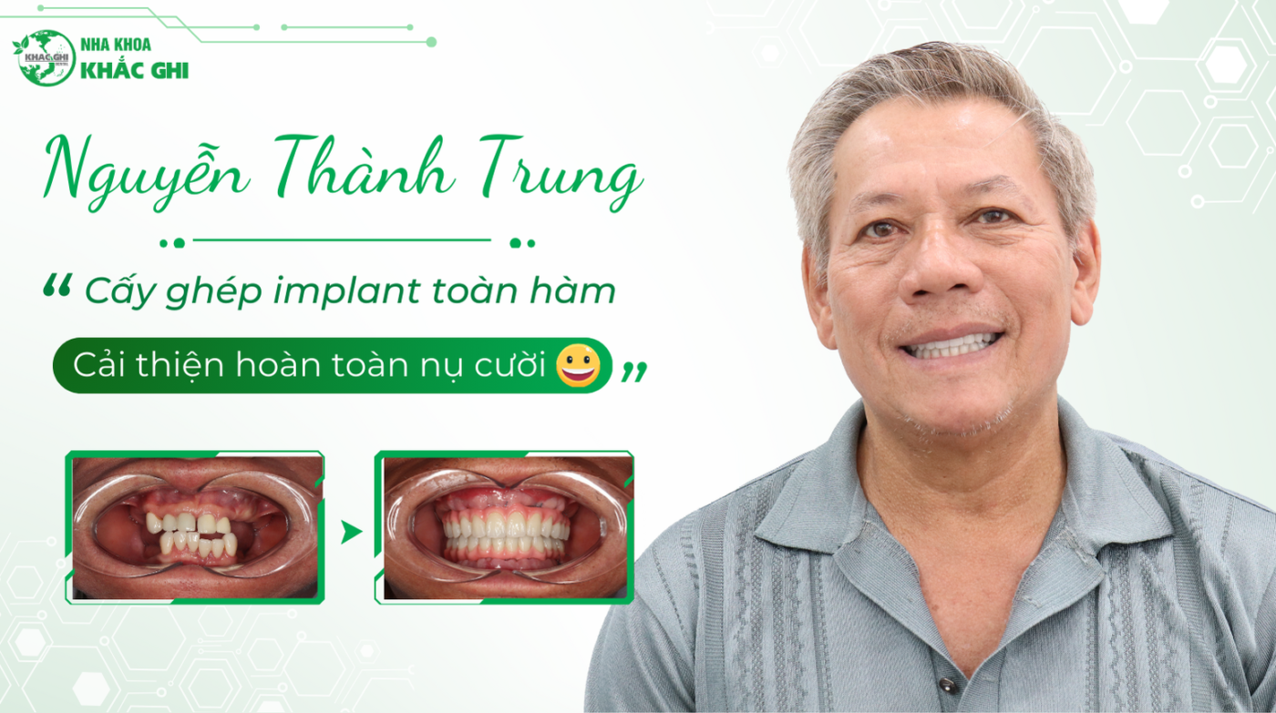 Nguyen Thanh Trung  Thumbnail website 1