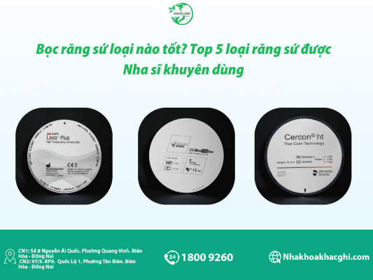 boc rang su loai nao tot top 5 loai rang su duoc nha si khuyen dung 7433