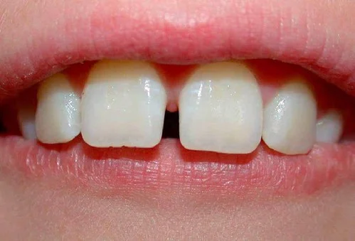 bocsuchorangthua002 1587
