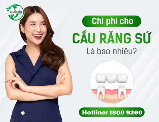 chi phi lam cau rang su gia bao nhieu tien 8317