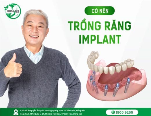 co nen cay ghep implant hay khong 1502
