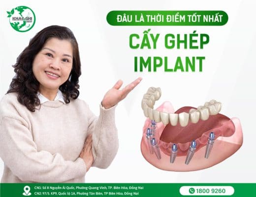 dau la thoi diem tot nhat de cay ghep implant 5927