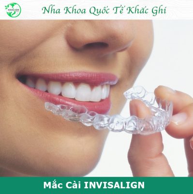 dia chi nieng rang trong suot bien hoa gia re 5302