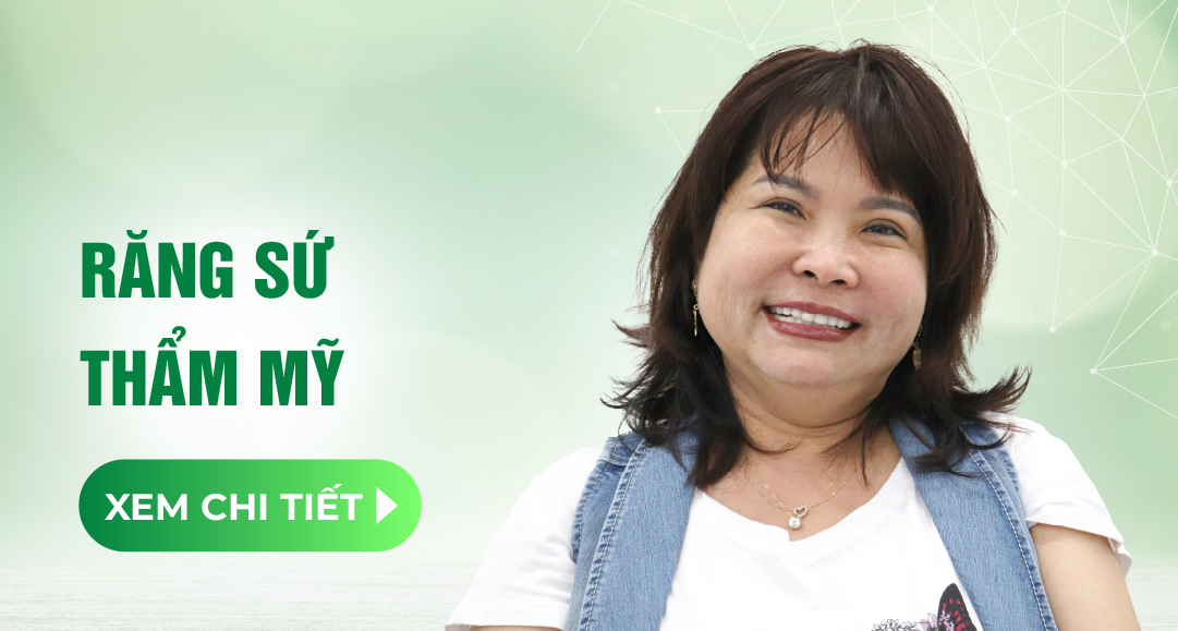 dich vu rang su tham my