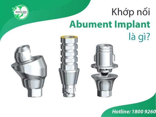 khop noi abutment implant 3372