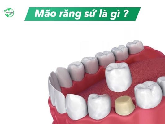 mao rang su 9562