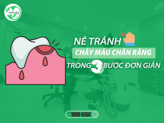 ne tranh chay mau chan rang chi trong 3 buoc don gian 7463