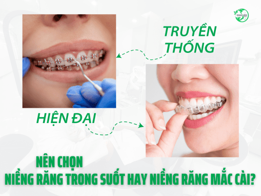 nen chon nieng rang trong suot hay nieng rang mac cai 1146