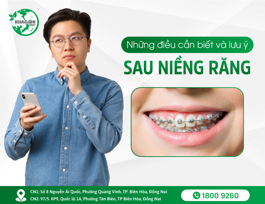 nhung luu y khi nieng rang ban can phai biet 4252