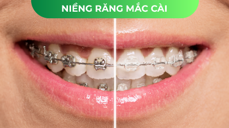 nieng rang mac cai