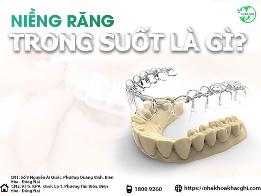 nieng rang trong suot invisalign 1404