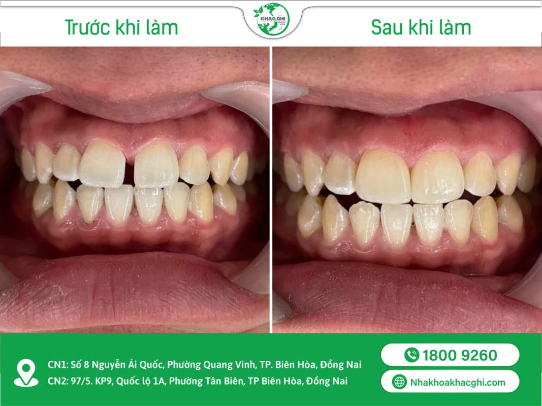 rang cua thua co nen boc su 6802