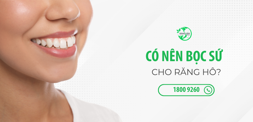 Răng hô có nên bọc sứ thẩm mỹ hay không? 3 rang ho co nen boc su tham my hay khong 4319