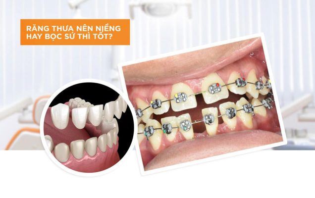 rang thua nen nieng hay boc su 9913