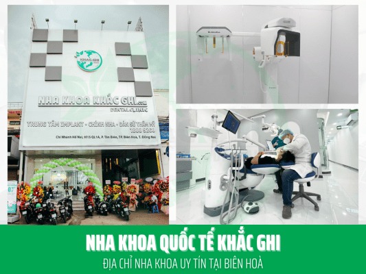 top 10 trung tam nha khoa trong implant uy tin 3607