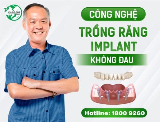 trong implant co dau khong cach giam dau hieu qua 2023 6555