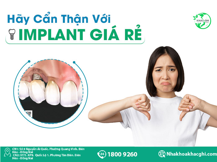 trong rang implant gia re 5665