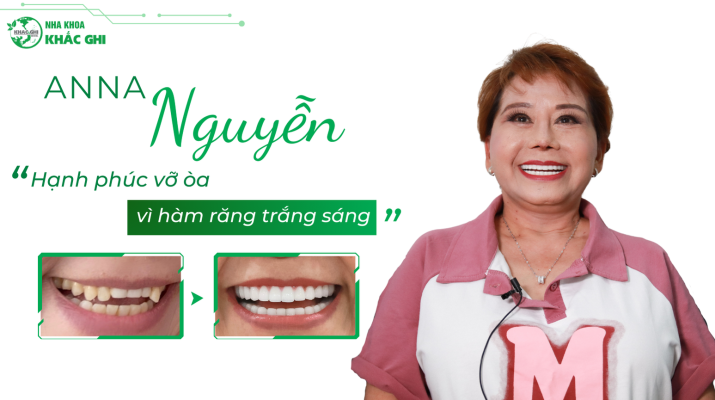 Anna Nguyen Thumbnail website x2 1