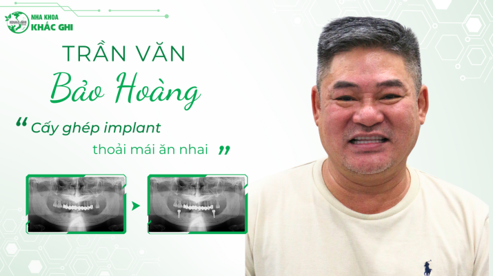 Tran Van Bao Hoang thumbnail website