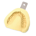 buoc ba trong implant