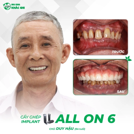 tinh trang truoc va sau khach so ba