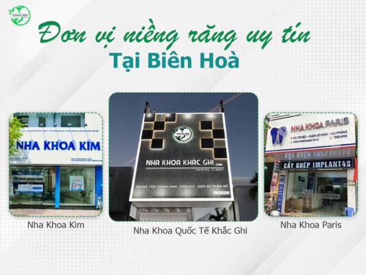 nieng rang o dau uy tin top 10 dia chi tot nhat hien nay 1