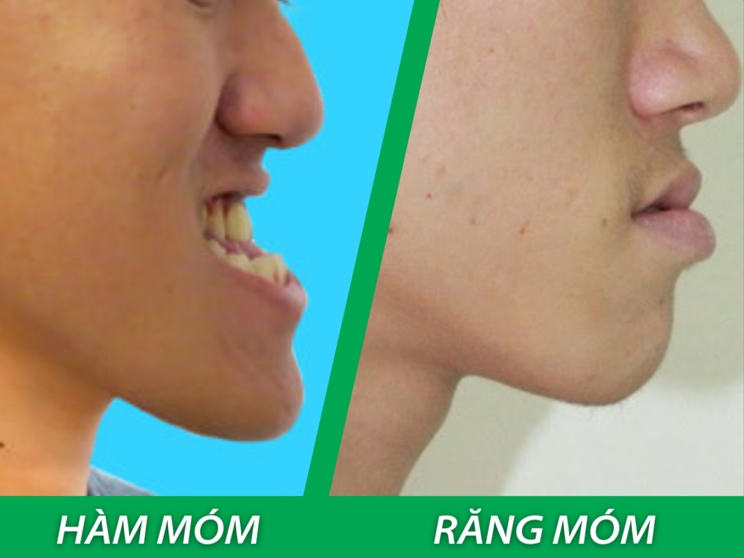 rang mom 4