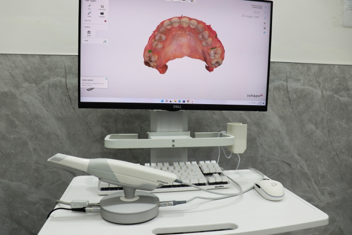 Máy scan trong miệng 3Shape Trios 3