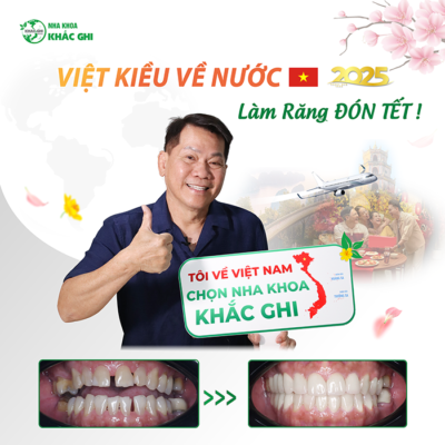 2025 SU WEB UU DAI RANG SANG CUOI XINH LUNG LINH DON TET Khach Viet Kieu NGUYEN DANG CUONG 33219