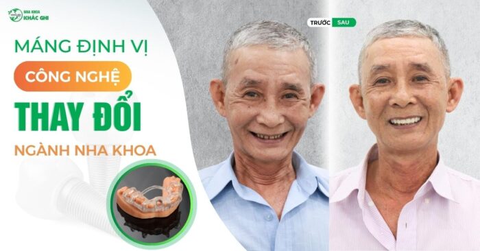 250404 BAI DANG WEB MANG DINH VI CONG NGHE THAY DOI NGANH NHA KHOA