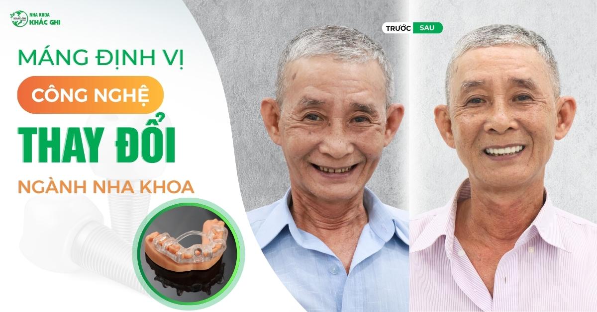 250404 BAI DANG WEB MANG DINH VI CONG NGHE THAY DOI NGANH NHA KHOA