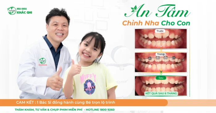 Chỉnh nha tăng trưởng trẻ em