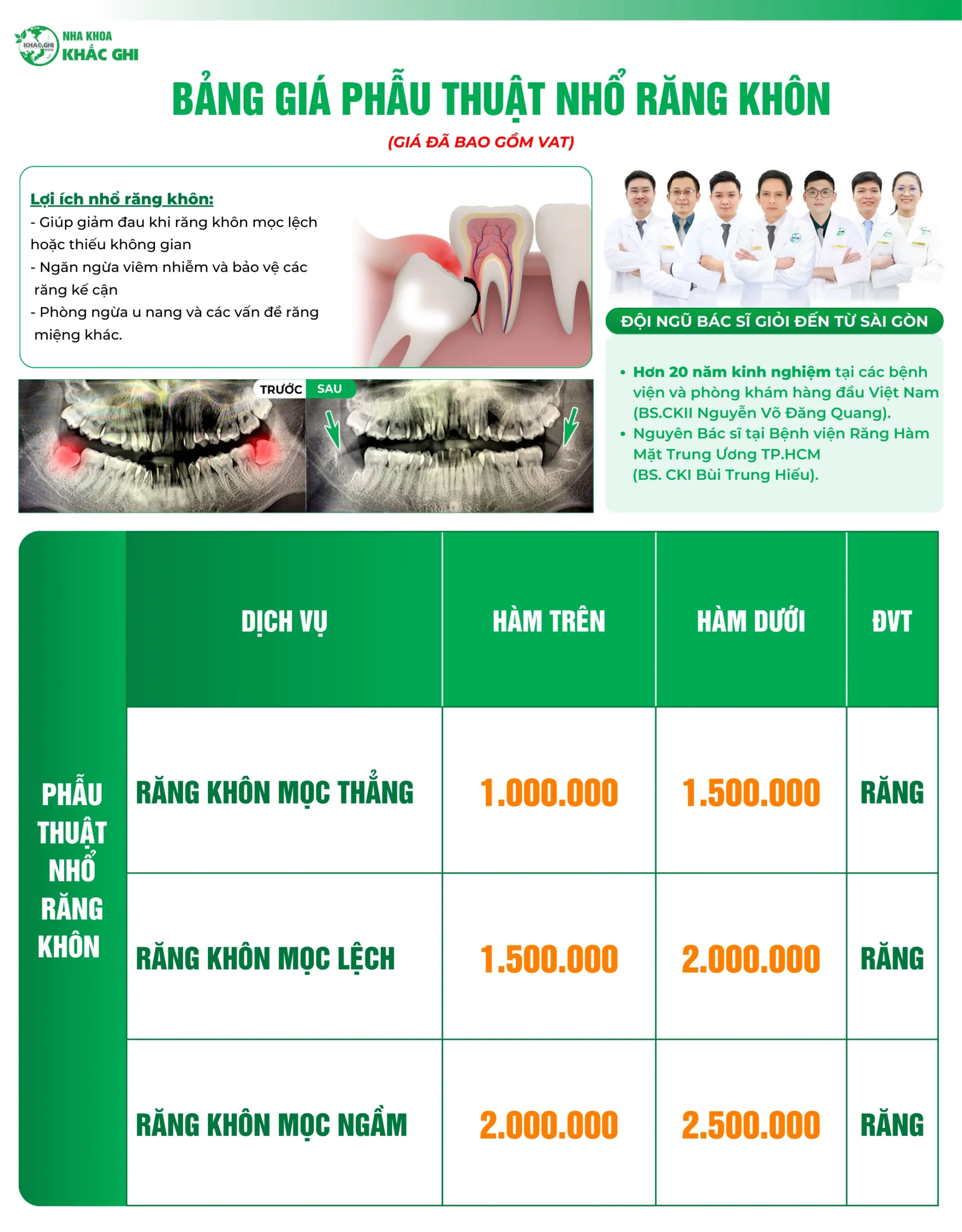 nhổ răng khôn Biên Hòa giá bao nhiêu