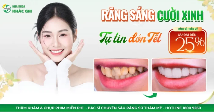 Ưu đãi Răng Sứ Thẩm Mỹ
