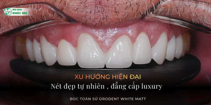 Răng sứ tự nhiên