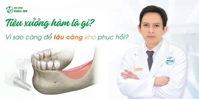 mất răng lâu năm