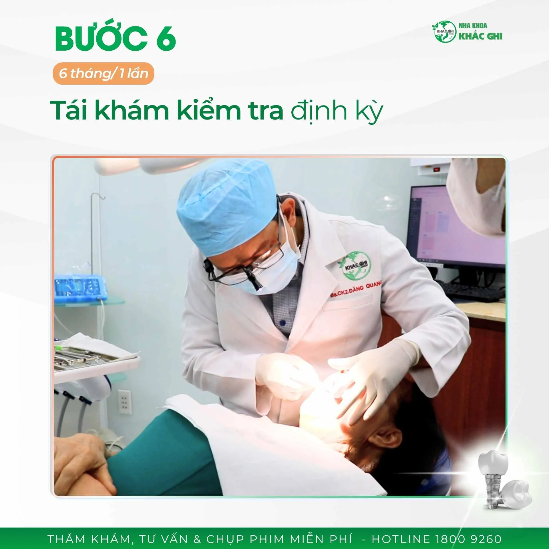 Quy trình phục hình sứ toàn hàm cố định trên Implant diễn ra như thế nào? 44 250507 CSKH QUY TRINH CAY GHEP IMPLANT TOAN HAM 7