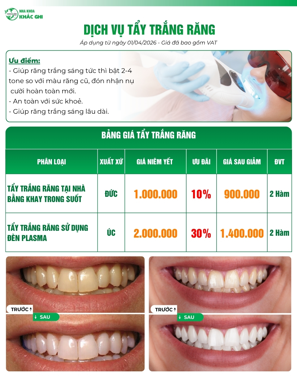 Bảng giá tẩy trắng răng tại nha khoa Khắc Ghi