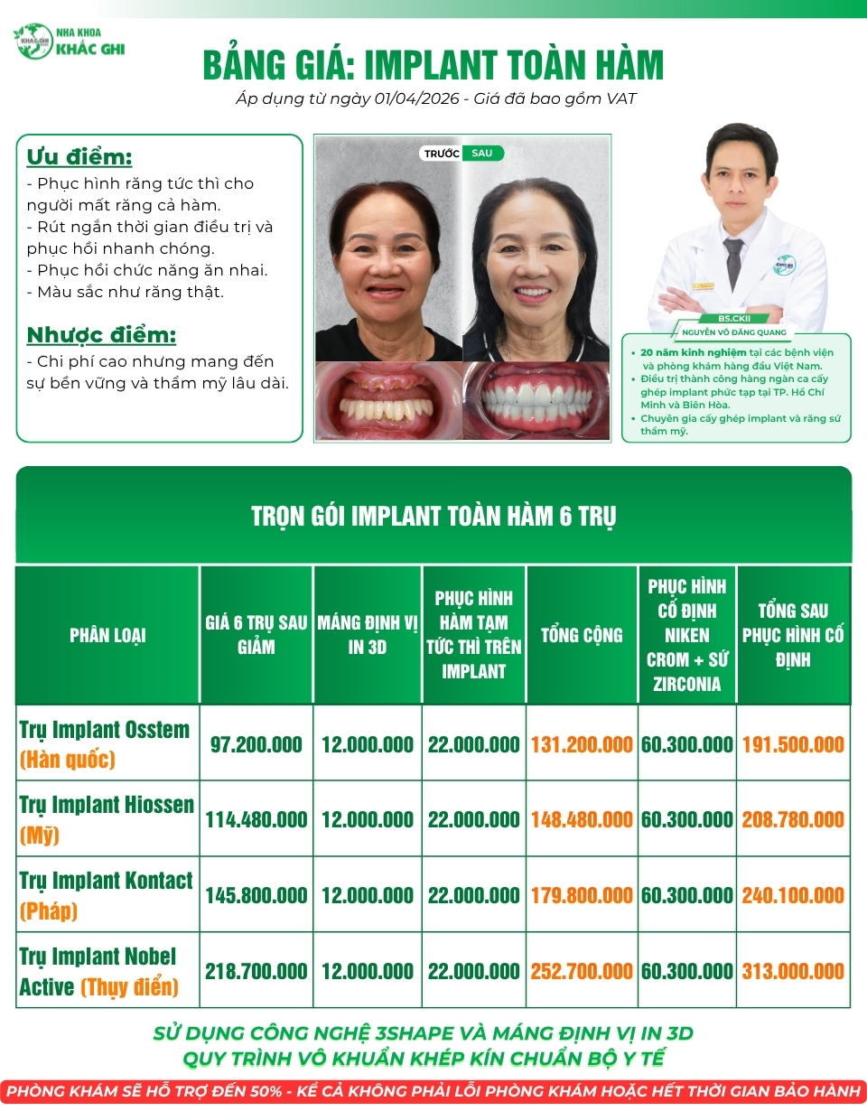 Bảng giá trồng răng implant toàn hàm all on 6 tại nha khoa Khắc Ghi
