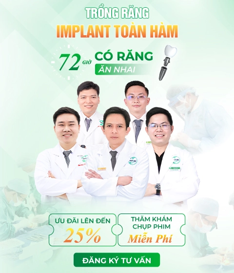 Dịch vụ trồng răng implant tại Nha Khoa Khắc Ghi