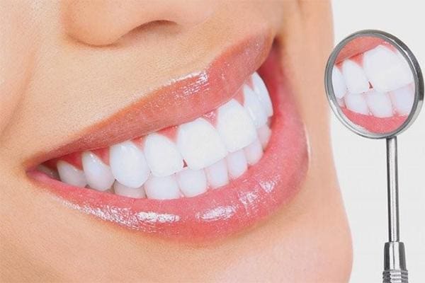 Bọc răng sứ hai răng cửa giá bao nhiêu
