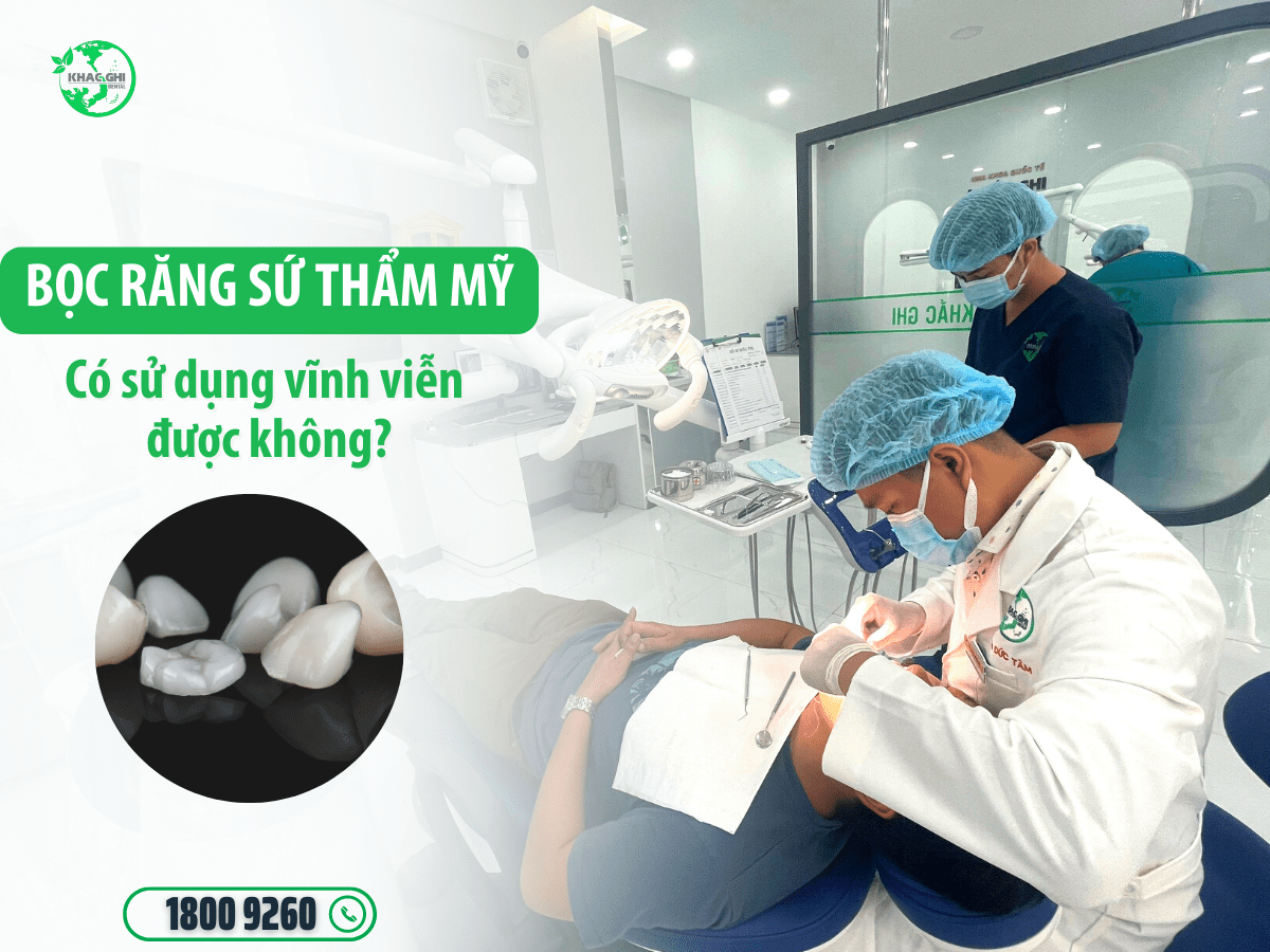 Bọc răng sứ vĩnh viễn được không ? Yếu tố ảnh hưởng đến bọc răng sứ