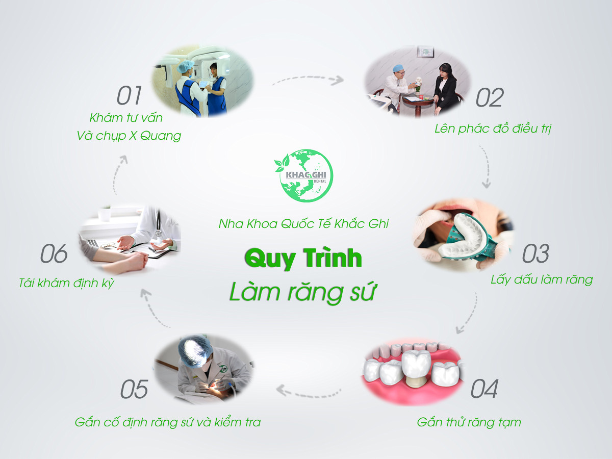 Quy trình bọc răng sứ tại Nha khoa Khắc Ghi được đánh giá cao, đạt chuẩn y khoa