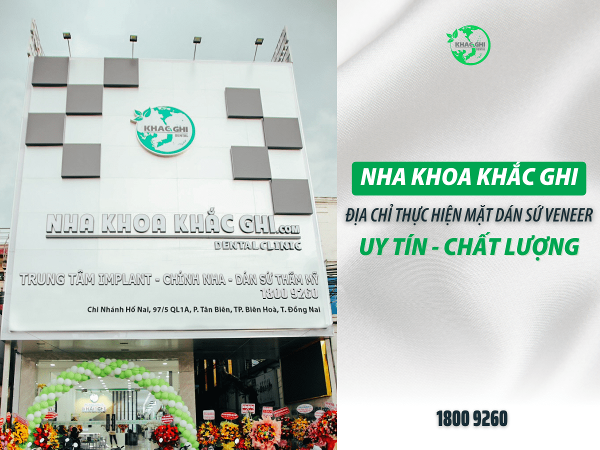 Dán Răng Sứ Veneer Ở Đâu Tốt Tại Biên Hòa 10 Dan rang su veneer o dau tot tai bien hoa 1