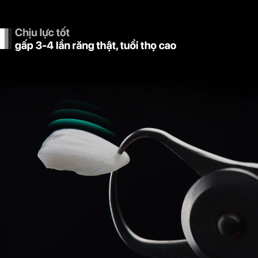dan su veneer co tot khong truong hop nao nen dan su veneer 5