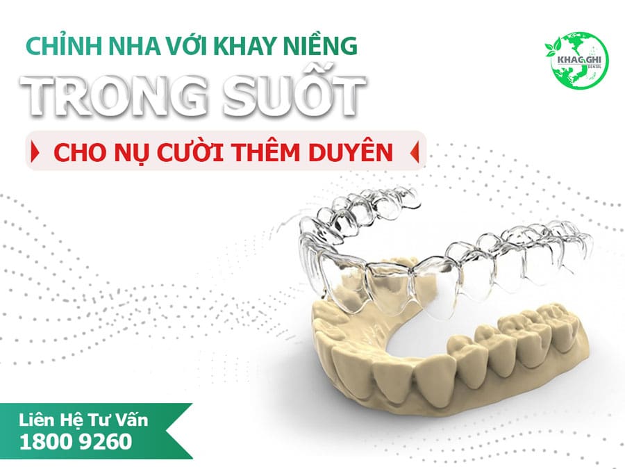 Địa Chỉ Niềng Răng Trong Suốt Biên Hòa Giá Rẻ 6 Nieng rang trong suot nhakhoakhacghi