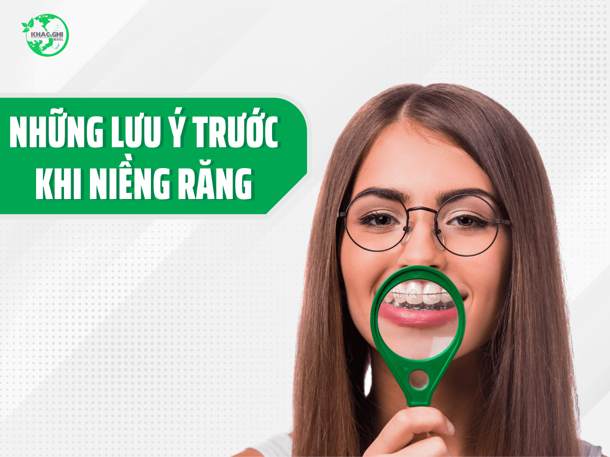 nhung luu y khi nieng rang ban can phai biet 1