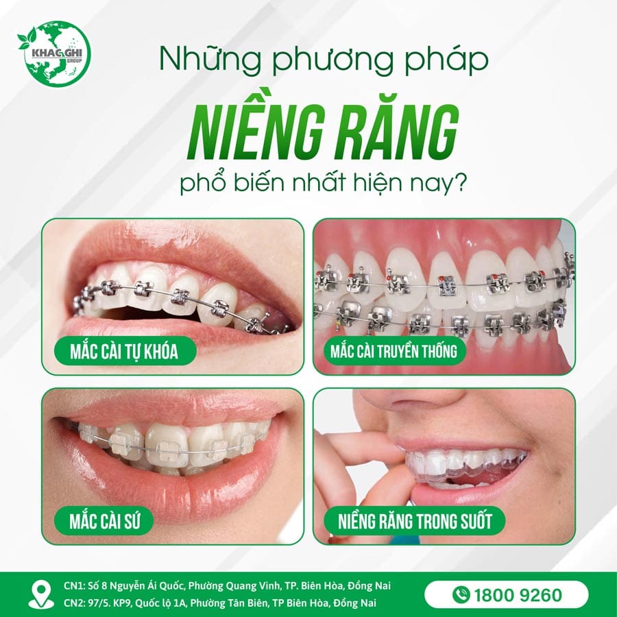 Những phương pháp niềng răng chỉnh nha phổ biến hiện nay
